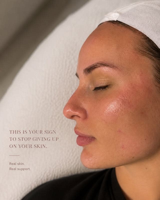 Our approach to acne: barrier repair, inflammation, skin health — real support.